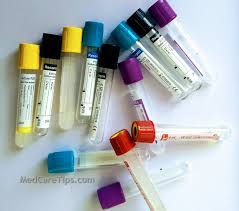 Vacutainer And Their Use In Blood Sampling Medcaretips Com