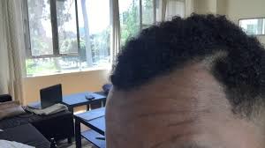 If you don't have the time or money to head to the salon for coloring, there's no need to worry. Black Men Thinning Hair Solution Youtube