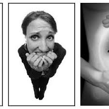 PDF) New Tests for Language Mapping with Intraoperative Electrical  Stimulation of the Brain to Preserve Language in Individuals with Tumors  and Epilepsy: A Preliminary Follow-Up Study