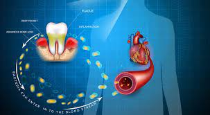 What Is The Relation Between Root Canals And Heart Issues Irvine Endodontics