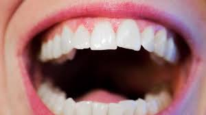 Salah satu arti mimpi gigi patah paling umum berkaitan dengan kehilangan pribadi yang dalam. Ternyata Menurut Primbon Jawa Mimpi Gigi Patah Petanda Baik Berikut Tafsir Mimpi Tentang Gigi Tribun Jambi