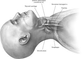 Check spelling or type a new query. Transoral Stapling Technique For Zenker S Diverticulum Sciencedirect