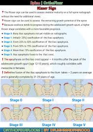 Image result for Risser Sign