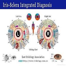 Pin By Cj Eldard On Self Care Iridology Chart Eye Chart