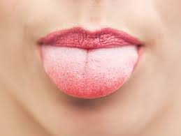 Toothpaste that gives you a healthy smile, with specialized solutions tailored to you. Coated Or White Tongue Healthily