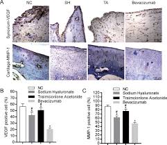 It is such a small dose of avastin, there will be no hair loss. Bevacizumab Tested For Treatment Of Knee Osteoarthritis Via Inhibition Of Synovial Vascular Hyperplasia In Rabbits Sciencedirect