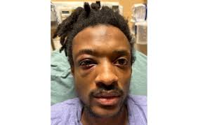 Suit alleges assault, retaliation by prison officers at two MD prisons