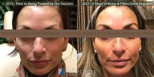 50 to 90% off deals in omaha. Best Botox Specials Near Me New Jersey Botox Cosmetic Price Cost