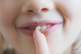 Some of the ways were shocking: How To Painlessly Pull Out A Loose Tooth Quora