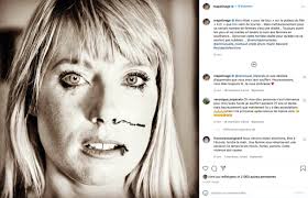 Mélanie Page : la femme de Nagui apparaît le visage tuméfié, les internautes  inquiets | CNEWS