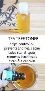 Pin On Best Tips