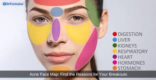 Image result for acne face