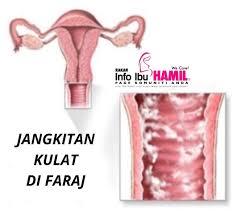 Kelembapan pada faraj akan menggalakkan pertumbuhan dan jangkitan mikroorganisma seperti kulat dan bakteria. Info Ibu Hamil Vagina Ibu Hamil Sangat Sensitif Mudah Facebook