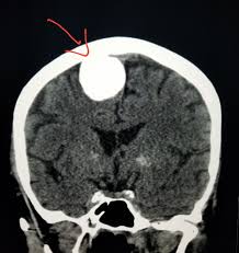 Pin On Ct Scans