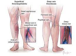 Pin On Fitness Mental Health