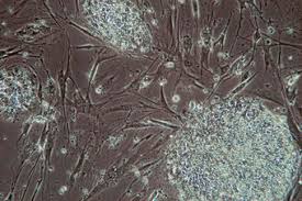 Check spelling or type a new query. Scientists Grow Two New Stem Cell Lines In Animal Cell Free Culture