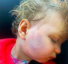 Social services missed FIVE chances to save Star Hobson