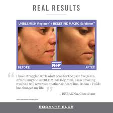 Rodan + Fields