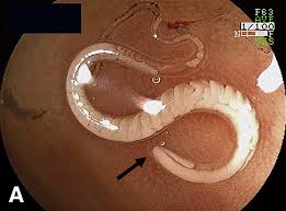 Image result for Whipworm