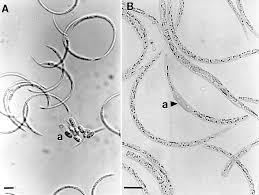 Image result for Raphidiocystis