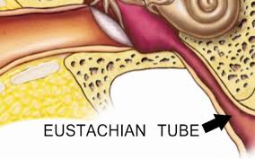 Image result for Eustachian Tube Dysfunction