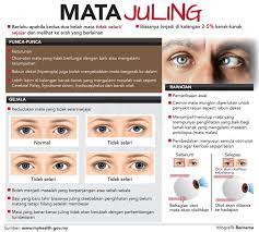 Pada orang dewasa mata juling dapat disebabkan karena. Bernama Tv On Twitter Infografik Mata Juling Infographics Crossed Eyes