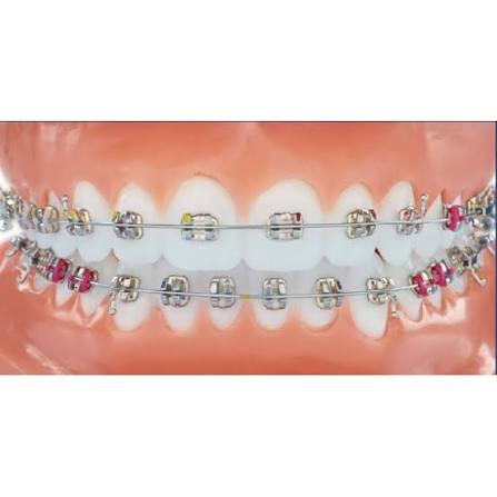 LEGEND Medium MBT .022 (pack of 10) (32557)