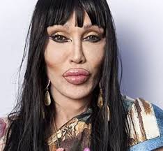 Desastres titânicos da cirurgia plástica