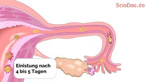 Wann findet die einnistung genau statt? Das Datum Fur Den Eisprung Befruchtung Einnistung Und Fruchtbare Tage Berechnen Sciodoo