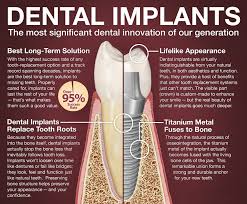 They also may know of insurance plans that can help cover the cost of your implants. Affordable Dental Implants Houston Ismile Specialists