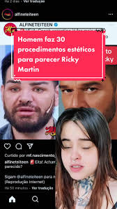 Homem fez 30 procedimentos estéticos para se parecer o Ricky Martin #fofoca  #noticias #fyp