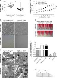 Uk regulated lim is the payment arm of 888 holdings. Loss Of Cyld Accelerates Melanoma Development And Progression In The Tg Grm1 Melanoma Mouse Model Oncogenesis