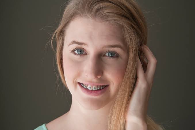 How to Make Fake Braces for Halloween | ehow