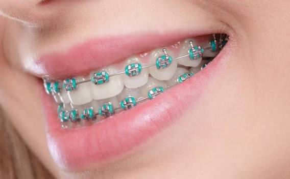 Brackets