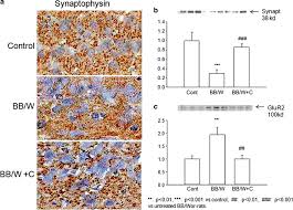 How do we know they're the hottest? C Peptide And Type 1 Diabetic Encephalopathy Springerlink