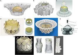 Frontiers Update On Transcatheter Tricuspid Valve Replacement Therapies Cardiovascular Medicine