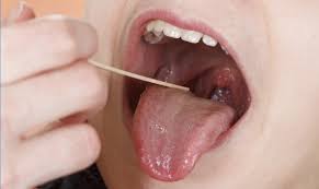 Les problèmes médicaux les plus courants sont les suivants Le Gout Metallique Que Vous Avez En Bouche Peut Etre Explique Par 8 Differentes Causes Une Pomme Par Jour