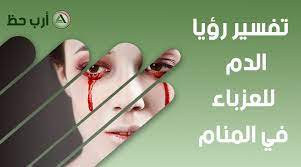 وأمَّا الرعاف في المنام أو خروج الدم من الأنف فله باب مستقل في. ØªÙØ³ÙŠØ± Ø­Ù„Ù… Ø§Ù„Ø¯Ù… ÙˆÙ‡Ù„ Ø±Ø¤ÙŠØ© Ø§Ù„Ø¯Ù… Ù…ÙƒØ±ÙˆÙ‡ ÙÙŠ Ø§Ù„Ù…Ù†Ø§Ù… Ø§Ø±Ø¨ Ø­Ø¸