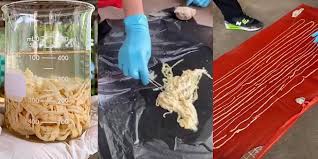 Dokter pun kaget ketika melihat ukuran cacing parasit yang ada dalam perut wanita ini. Mengeluh Sakit Perut Dokter Keluarkan Cacing Pita Sepanjang 17 Meter Dari Pria Ini Halaman All Tribun Batam