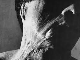 The united states detonated two nuclear weapons over the japanese cities of hiroshima and nagasaki on 6 and 9 august 1945, respectively. Life After The Atomic Bomb Testimonies Of Hiroshima And Nagasaki Survivors Humanitarian Law Policy Blog Humanitarian Law Policy Blog