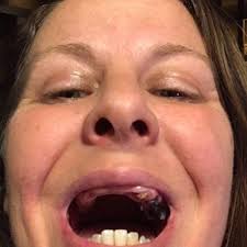 Fundraiser for Nicole Massey-Richards by Kathy Fiorentino : Restore Nikk's  Smile!!