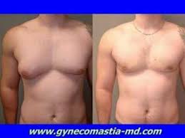 Breast lift with saline implants: Pin On Cosmetic Surgery
