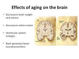 Learning Question What Conditions Can Arise From An Aged Ns Title The Effects Of Aging On The Nervous System Homework You Have Your Class Test Next Ppt Download