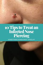 See full list on wikihow.com 10 Tips To Treat An Infected Nose Piercing
