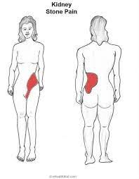 Pin On Health Wellness