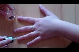 Video Abgekaute Fingernagel Das Hilft Beim Wachsen