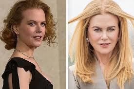 Nicole Kidmans unrecognizable face leaving fans worried: Whats  happening to her face? | Marca