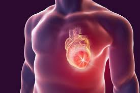 Sca usually causes death if it is not treated within minutes. Understanding Who S At Risk For Sudden Cardiac Death