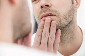 Is Herpes That Bad? What to Know About Rates and Effects