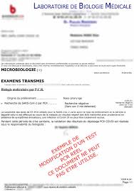 Comisia europeană a semnat în mod oficial legislația necesară certificatului digital covid la nivelul ue. Covid Des Faux Tests Negatifs Qui Trompent Meme Les Specialistes Le Parisien
